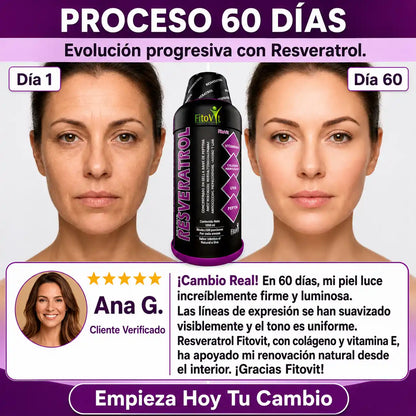 👵🏼RESVERATROL X 1.000 ML FITOVIT👩🏻